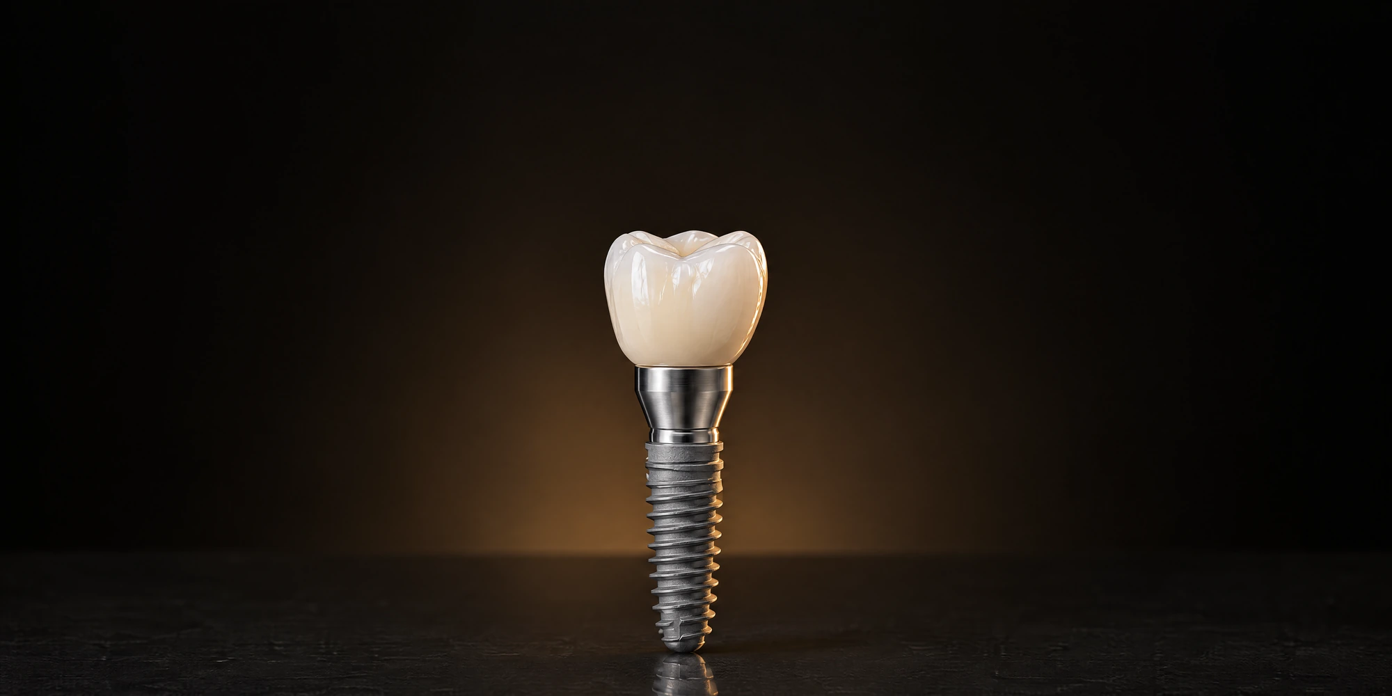 Illustration of a dental implant with a ceramic crown